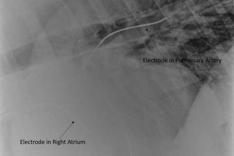 UC Davis Uses Transvenous Electrical Cardioversion To Correct Horse’s Atrial Fibrillation – Horse..