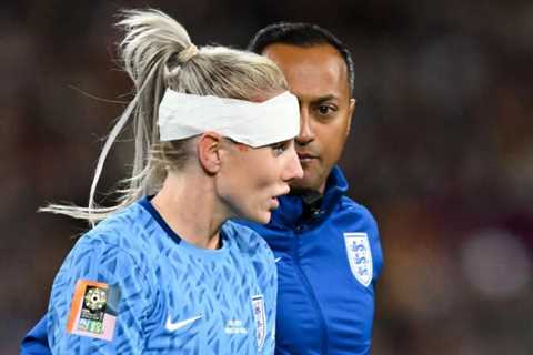 Alex Greenwood shows off gruesome bruise from head injury after returning from World Cup