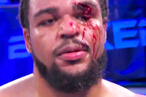 TKV Suffers Gruesome Eye Injury in Shock Loss to Igor Macedo