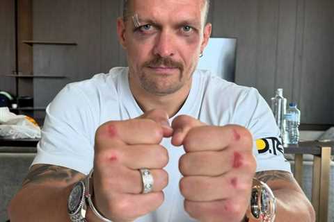 Oleksandr Usyk reveals battle scars after victory over Tyson Fury